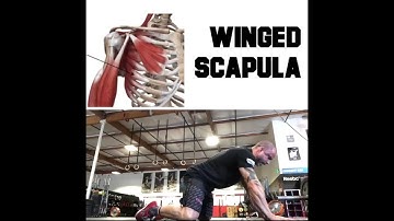 Winged Scapula Repair | Trevor Bachmeyer | SmashweRx