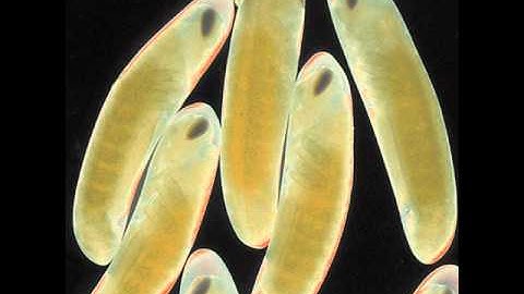 The Locust - Wet Nurse Syndrome Hand-Me Down Display Case