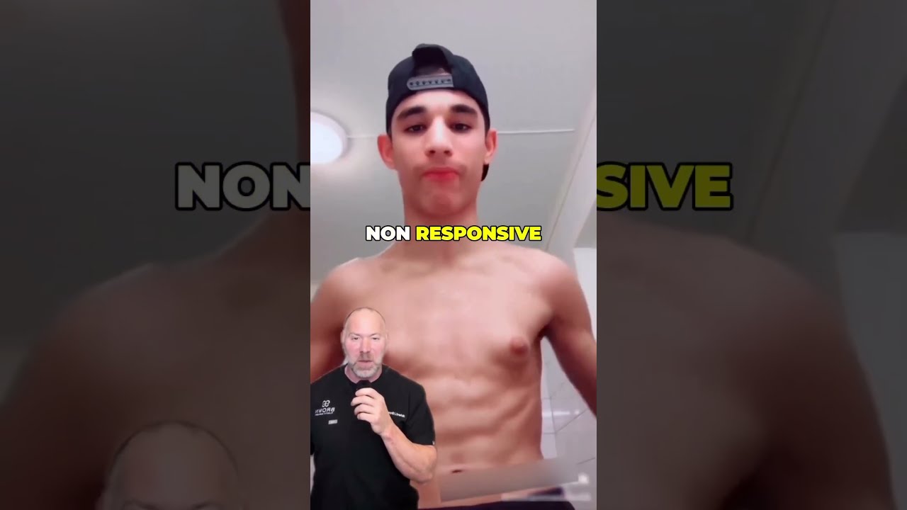 Gynecomastia Isn T About Weight Shorts