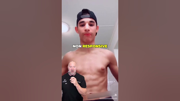 Gynecomastia Isn’t About Weight ❌ #shorts
