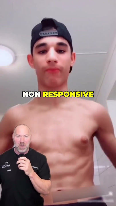 Gynecomastia Isn’t About Weight ❌ #shorts