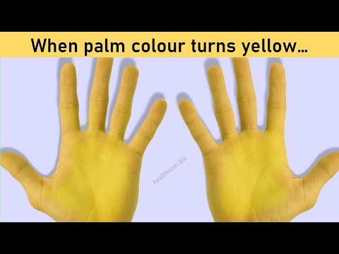 Yellow Hands..