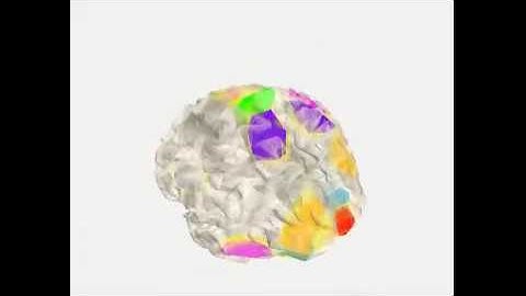 MOST-EEG Brain Scan Technology (Multiple Origin Spatio-Temporal Modeling)