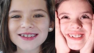 EMMA GETS BRACES!!   |  KittiesMama