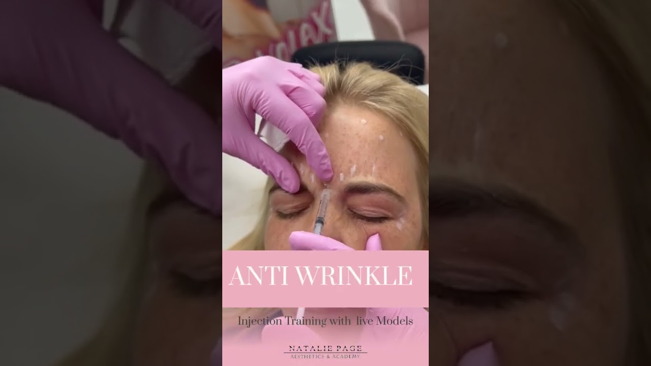 How Long Does Anti-Wrinkle Botox Last?