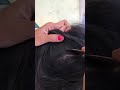 #fypviralシ #statisfying #lice #hair #LiceOnHead #liceremoval  #brasil #xyzbcafyp #licecomb  #kutu