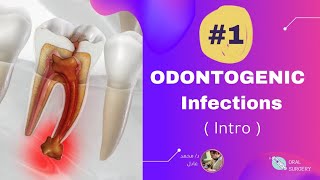 Odontogenic Infections (#1 Intro) | د. محمد عادل