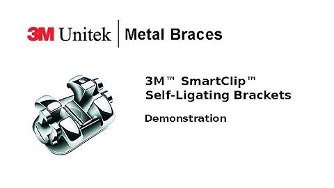 3M Unitek Metal Braces | www.bangkokbraces.com