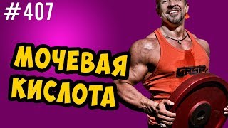 мочевая кислота