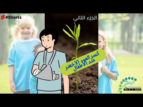 فيديو: لماذا تعد كسور الغصن النضير أكثر شيوعًا؟