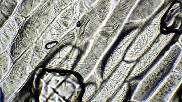 Onion cells under a microscope 400x 1000x