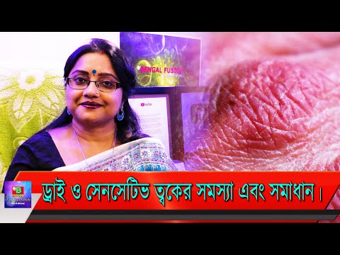 ভিডিও: কন্যা জাভেরোত্নিয়ুক ত্বকের সমস্যা শুরু করেছিলেন