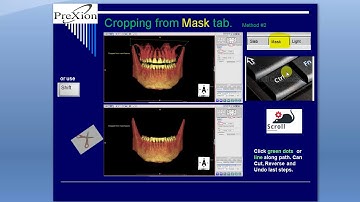 PreXion Training Tips: Crop and Cut On-screen Images