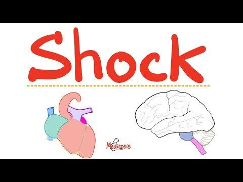 Trauma & Shock (Hypovolemic, Cardiogenic, Obstructive, Neurogenic, Septic, Anaphylactic shock)