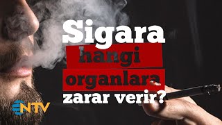 Sorucevap Sigara Hangi Organlara Zarar Verir?