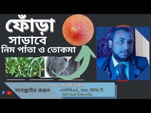 ভিডিও: বাড়িতে ফোড়ার চিকিৎসা করার 4 টি উপায়