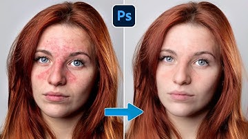 How to remove red patches on skin most accurately in Photoshop! TTGRAPHIC