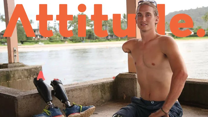 Surviving a Triple Amputation: Cameron Clapp