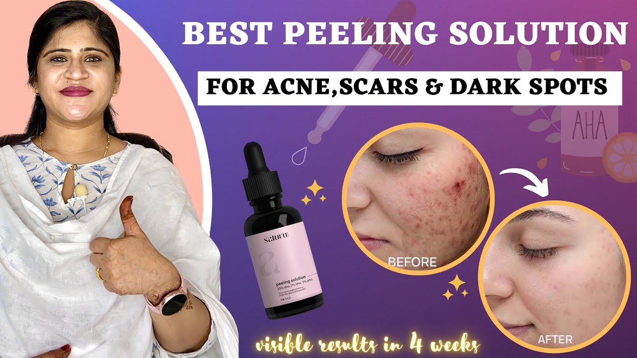 Acne & Scars Treatment Saturn AHA BHA Peeling Solution For Glowing