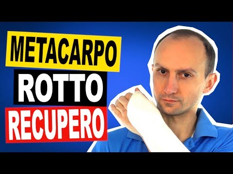 Frattura del Metacarpo: Esercizi di Riabilitazione e Come Guarire Presto