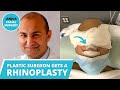 My rhinoplasty journey  plastic surgeon gets his nose done  dr tanveer janjua  new jersey