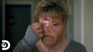 Una abuela con un agujero en la cara producto de un cáncer | Mi Cuerpo, Mi Desafío | Discovery