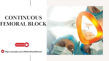 Continuous Femoral Block
