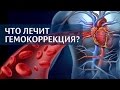 Что лечит экстракорпоральная гемокоррекция крови?