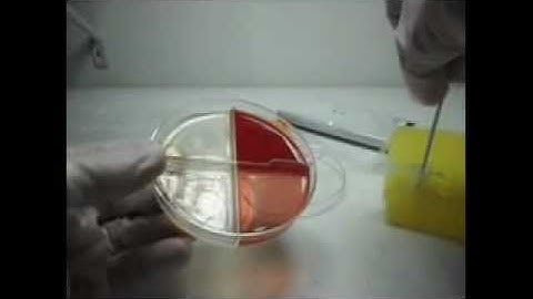A Novel Antimicrobial Susceptibility Test To Help Combat Antibiotic Resistance-short version