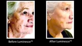 Результаты применения омолаживающей продукции Jeunesse Global(Результаты применения омолаживающей продукции Jeunesse Global. Регистрация: http://goo.gl/TqztdL Помощь в регистрации:..., 2015-02-12T11:22:09.000Z)