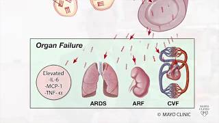 Pancreatic triglyceride lipase mediates lipotoxic systemic inflammation