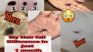 #shorts #youtubeshorts My hair fall difference in 1 month