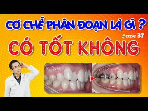 Video: Phân đoạn kênh là gì?