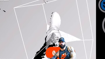 Apple iPad 3D Prosthetic Scan via Structure Sensor Demo