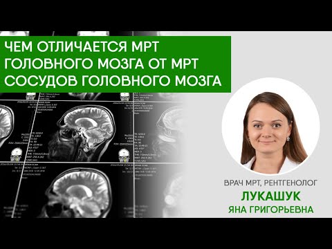 Чем МРТ головного мозга отличается от МРТ сосудов головного мозга