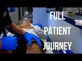 FULL Patient JOURNEY To  MAINTAIN MOBILITY  In Troublesome  KNEE    Baltimore Chiropractor