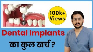What is the cost of DENTAL IMPLANTS ?