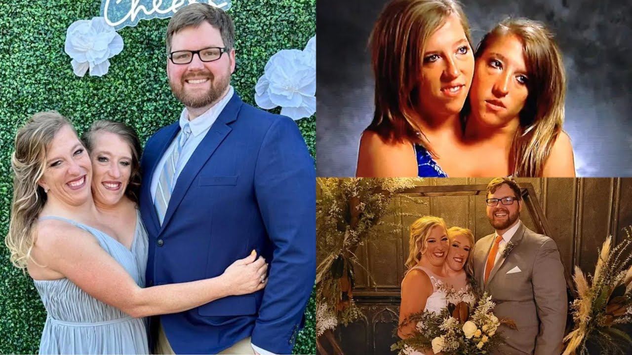 Umwe mu mpanga zavutse zifatanye yakoze ubukwe bitangaza benshi/urukiko rwabanje kubyanga