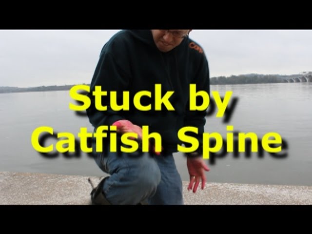 I get stabbed in the wrist by a catfish spine - Warning: A little