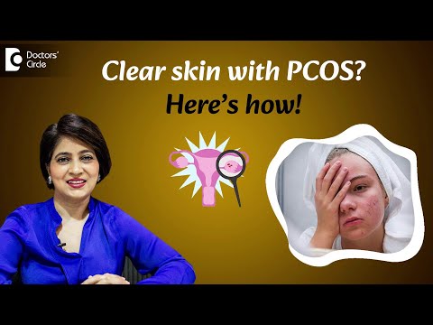 PCOS Acne Treatment