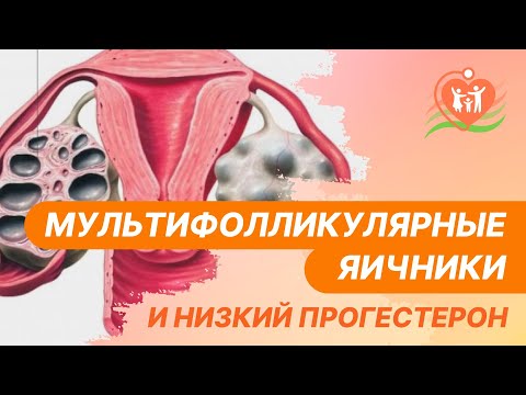 📌 Мультифолликулярные яичники и низкий прогестерон