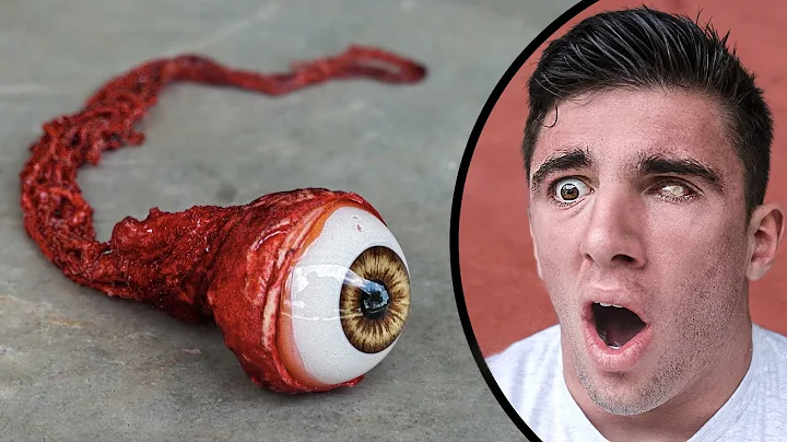 MY EYEBALL FELL OUT IN PUBLIC!