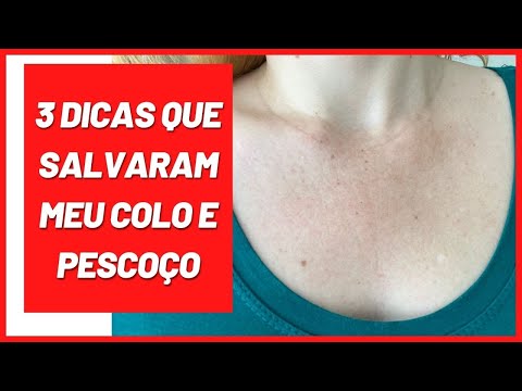 Vídeo: 3 maneiras de tratar uma erupção no pescoço