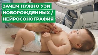Зачем нужно УЗИ новорожденных / Нейросонография г.Кострома / МЦ МИРТ Зачем нужно УЗИ новорожденных / Нейросонография г.Кострома / МЦ МИРТ