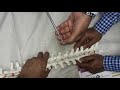 Spine operation techniques 