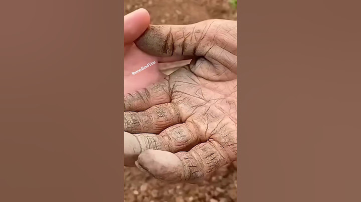 Get Rid Of Extremely Dry Cracked Hands| Hand Moisturizer For Soft & Supple Hands | #shorts #viral