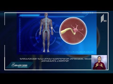 ვის უქმნის საფრთხეს ზიკა ვირუსი?