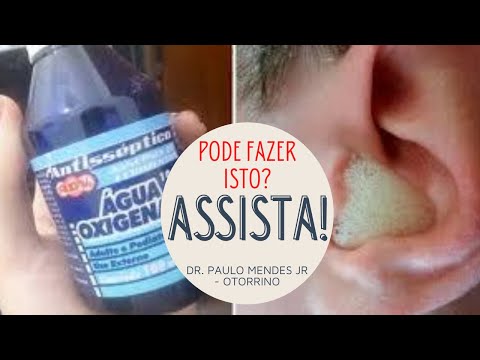 Vídeo: Como limpar sua orelha com peróxido de hidrogênio: 10 etapas