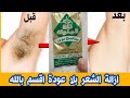 بدون سويت ولا شفرات وبكيس واحدة هتعملى إزالة لشعر الجسم كله والمناطق الحساسةنهائيا،هتبقى شمعة منورة