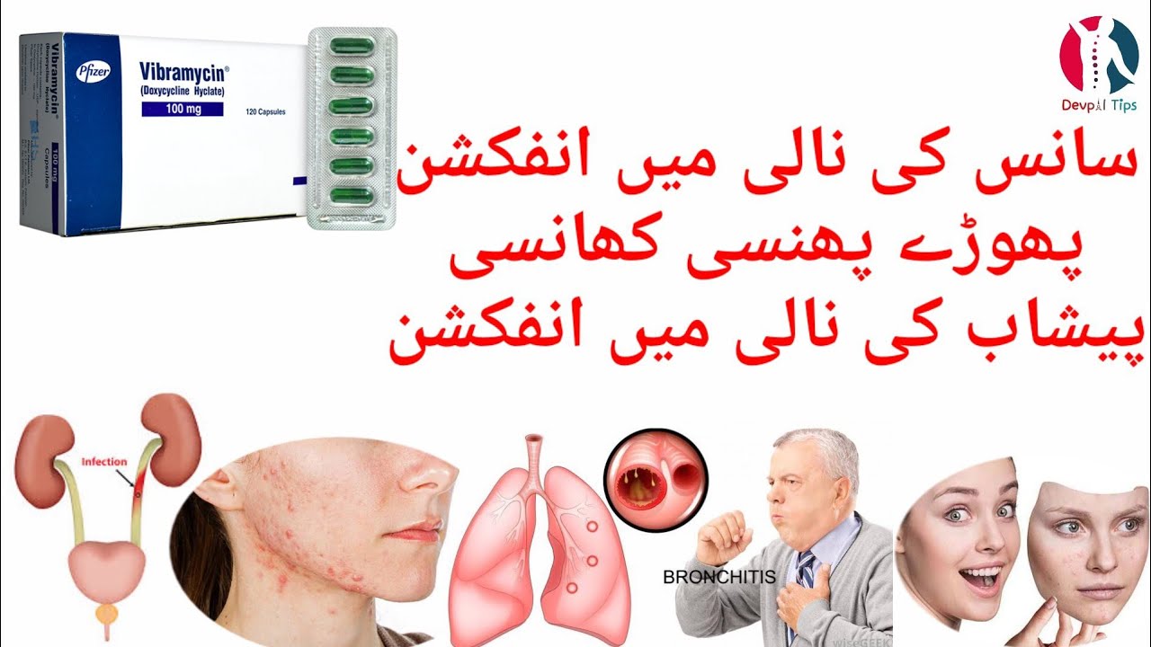 doxycycline vibramycin cost